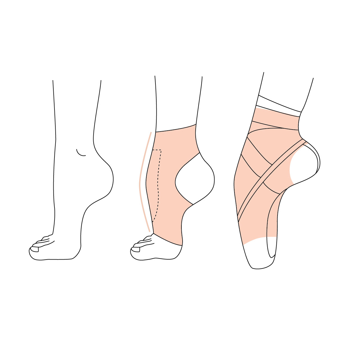 Arch Enhancer - Image 3